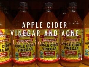 Apple Cider Vinegar and Acne