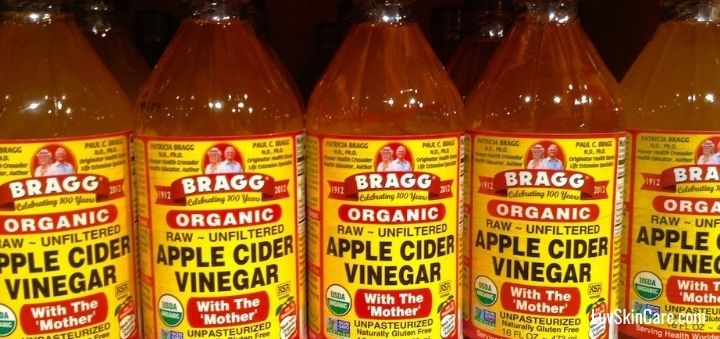 Apple Cider Vinegar and Acne