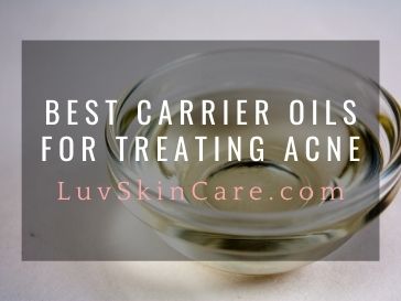Best Carrier Oils for Treating Acne