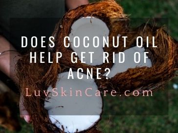 Does Coconut Oil Help Get Rid of Acne?