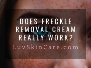 Does Freckle Removal Cream Really Work?