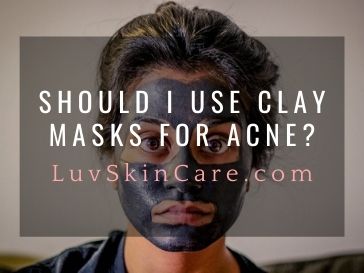 Should I Use Clay Masks for Acne?